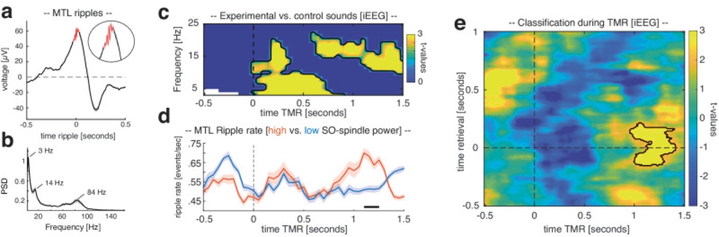 Ripples mark memory reactivation. Intracranial recordings during sleep cueing: spindle-locked ripples coincide with reactivated memories.